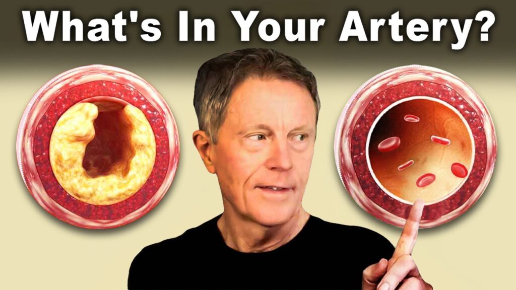 #1 Best AT HOME Test to Find Clogged Arteries