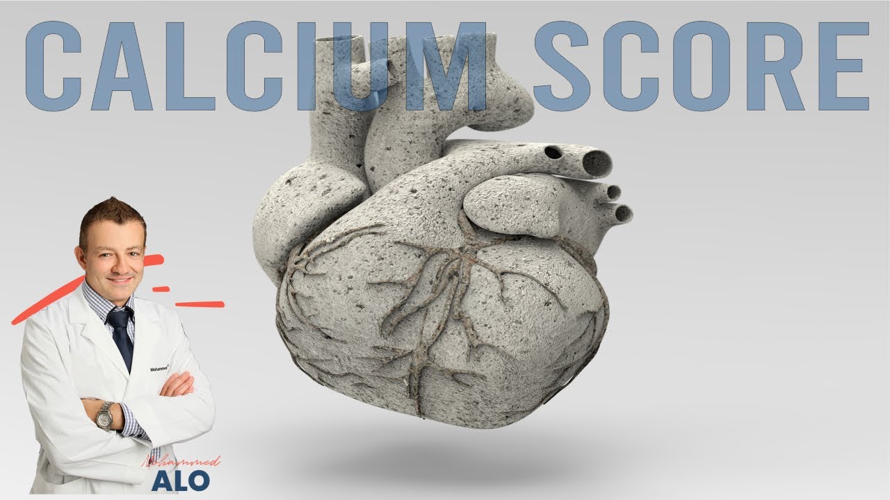 Can a Coronary Calcium Score Predict Heart Attacks? Cardiologist Explains